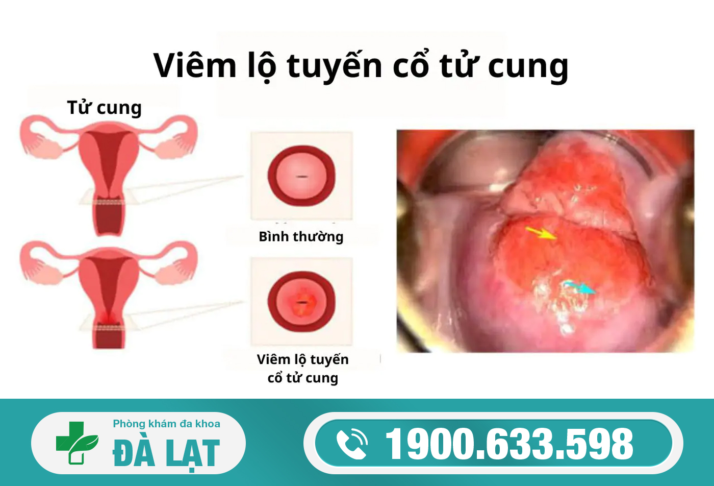 Hình ảnh minh họa